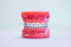 ashland-orthodontics-metal-braces.jpg ashland-orthodontics-metal-braces.jpg